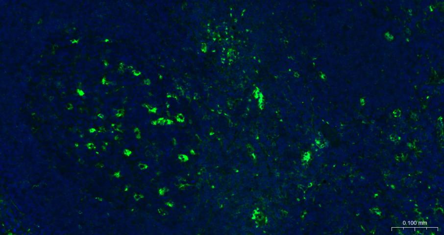 α-1抗胰糜蛋白酶/SERPINA3重组兔单克隆抗体