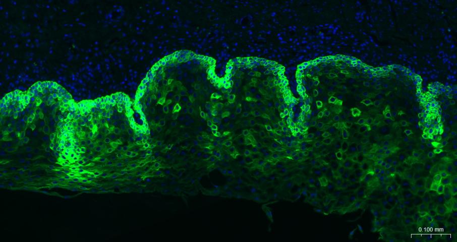 细胞角蛋白19重组兔单抗