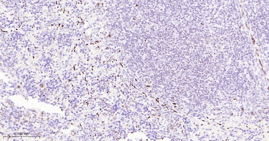 癌基因ERG重组兔单抗