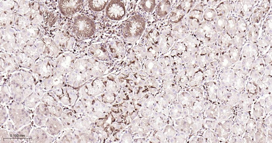谷胱甘肽硫转移酶pi重组兔单抗