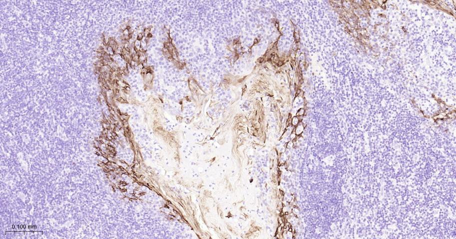 细胞角蛋白13重组兔单抗