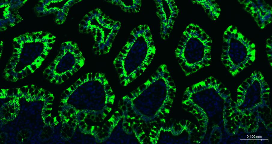 细胞角蛋白20重组兔单抗