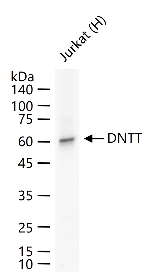 DNTT Recombinant Rabbit mAb (一抗) - WB,IHC-P,IHC-F,IF | Bioss