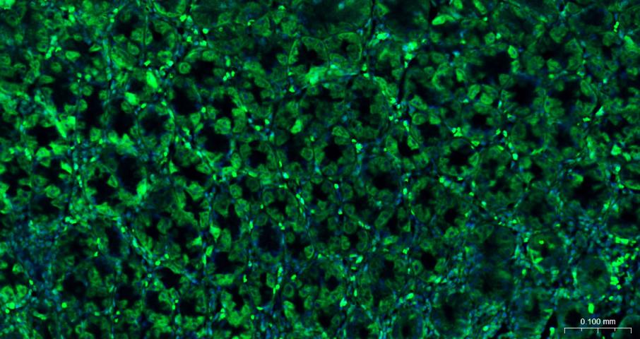 真核翻译起始因子4E重组兔单抗