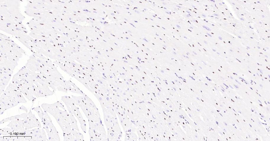 癌基因ERG重组兔单抗