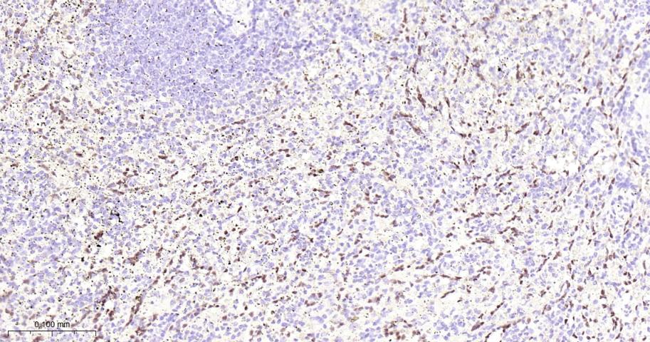 癌基因ERG重组兔单抗