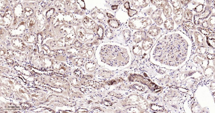 谷胱甘肽硫转移酶pi重组兔单抗