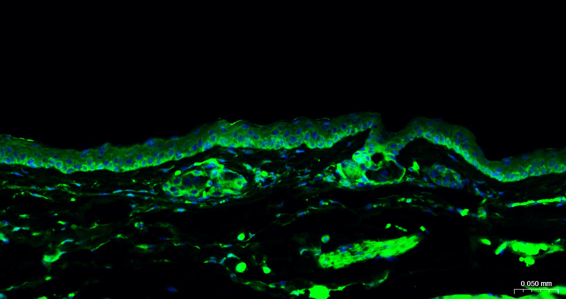 细胞角蛋白15重组兔单抗