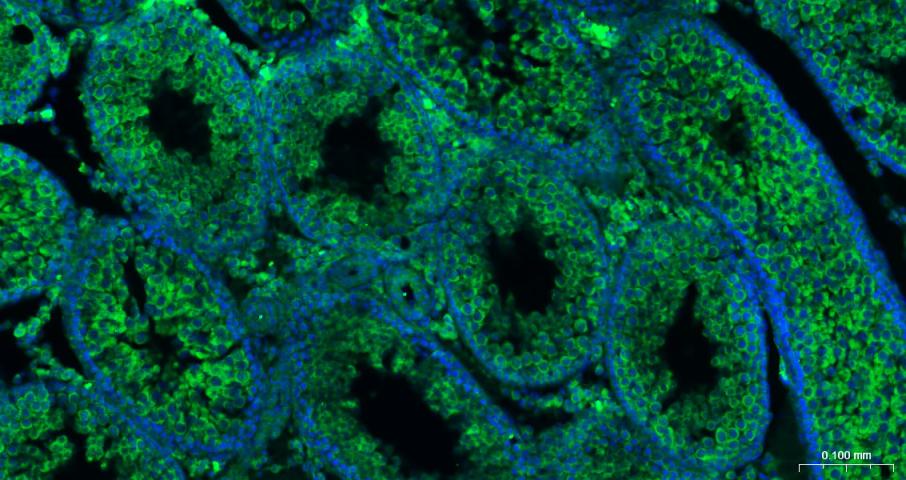 真核翻译起始因子4E重组兔单抗