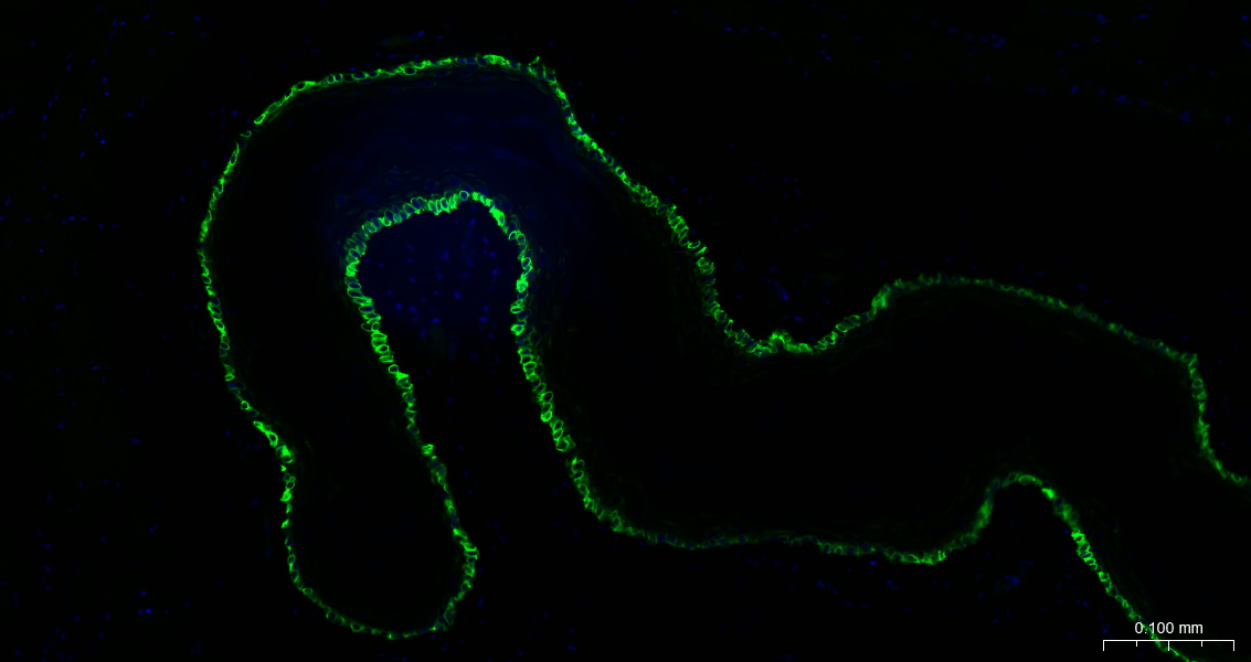 细胞角蛋白14重组兔单克隆抗体