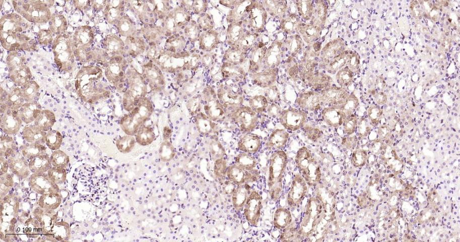 谷胱甘肽硫转移酶pi重组兔单抗