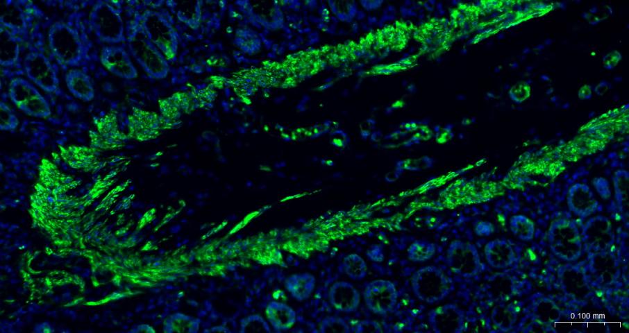 α-SMA重组兔单抗