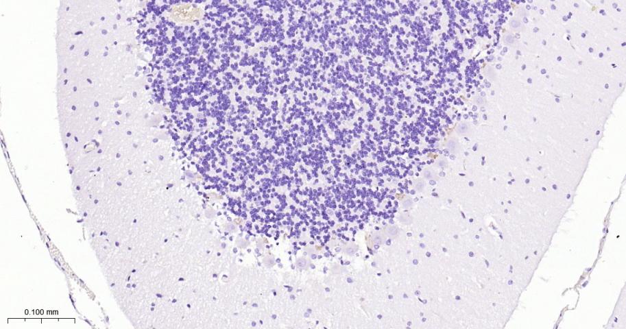 突触后密度蛋白95重组兔单抗