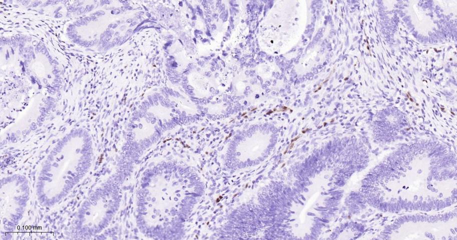 癌基因ERG重组兔单抗