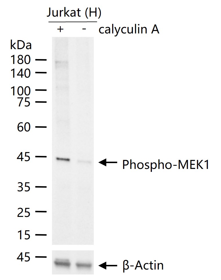 phospho-MEK1 (Thr292) Recombinant Rabbit mAb (一抗) - WB,IHC-P,IHC-F,IF | Bioss