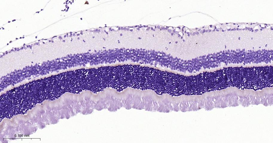突触后密度蛋白95重组兔单抗
