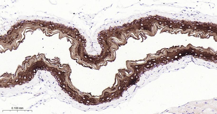 细胞角蛋白13重组兔单抗