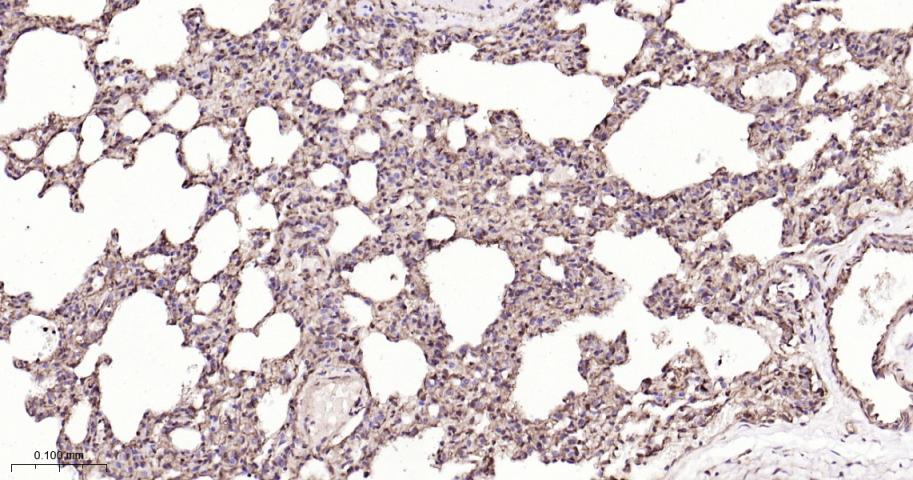 谷胱甘肽硫转移酶pi重组兔单抗