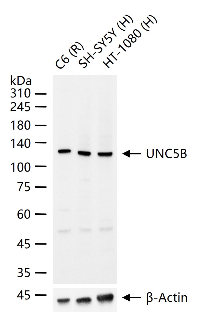 UNC5B Rabbit pAb (一抗) - WB | Bioss