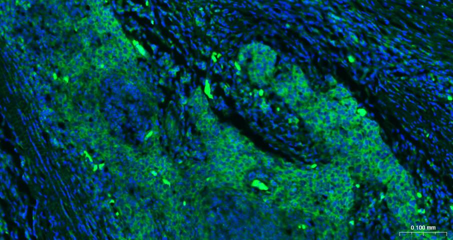 真核翻译起始因子4E重组兔单抗