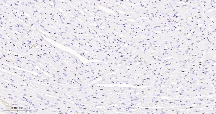 癌基因ERG重组兔单抗