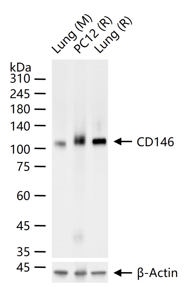 黑色素瘤细胞粘附分子CD146重组兔单抗