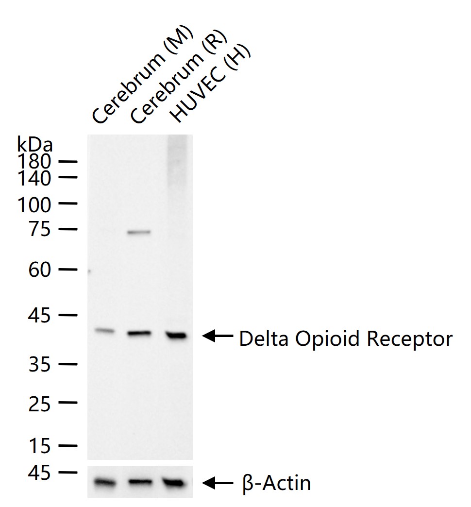 D型阿片受体重组兔单抗