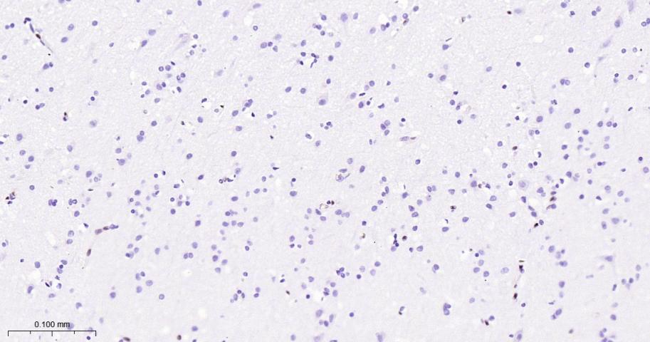 癌基因ERG重组兔单抗