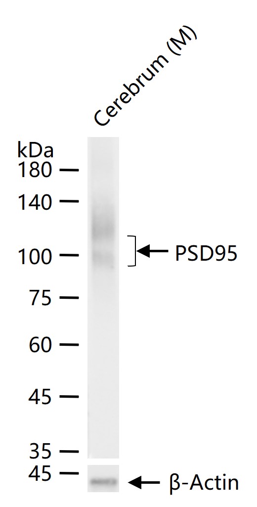 突触后密度蛋白95重组兔单抗