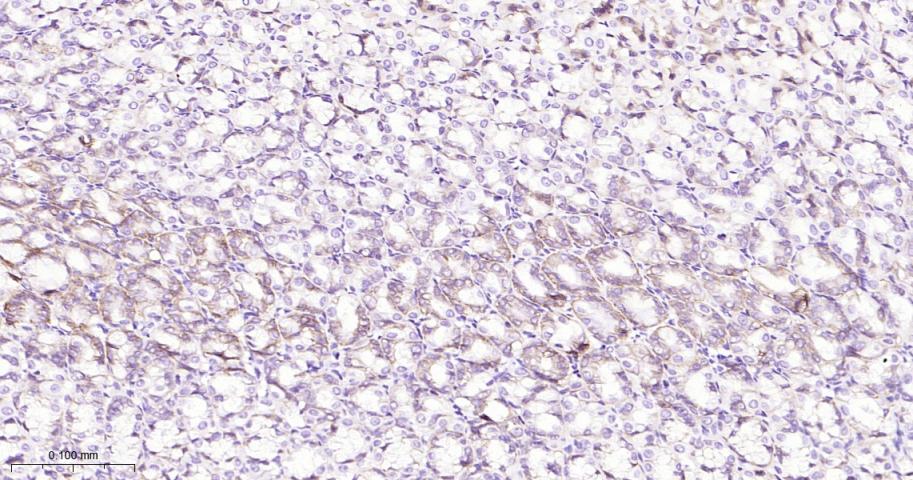 紧密连接蛋白18重组兔单抗