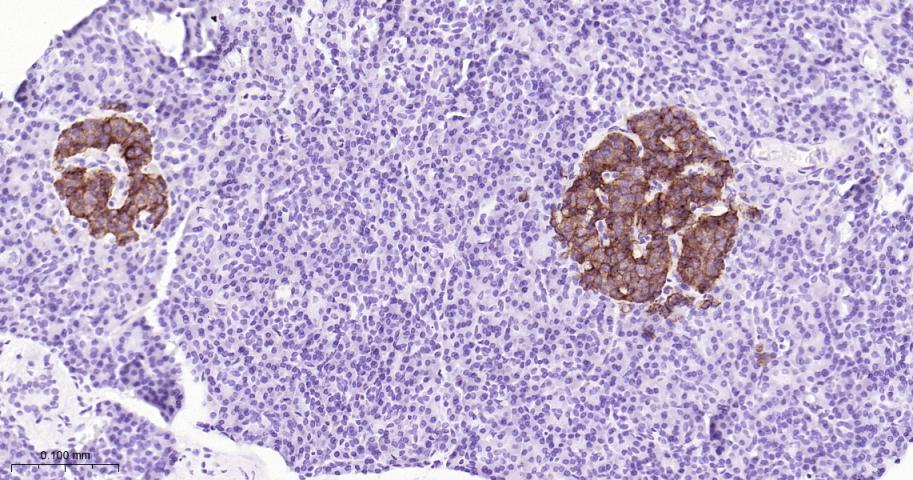 生长抑素受体2重组兔单抗