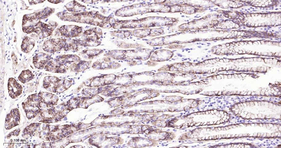 紧密连接蛋白18重组兔单抗