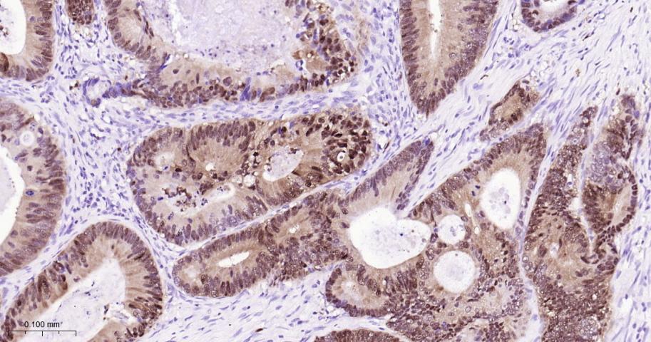 S100钙结合蛋白P重组兔单抗