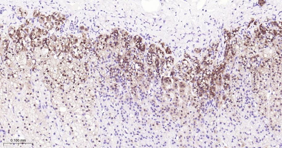 钙/钙调蛋白依赖性蛋白激酶 I重组兔单抗