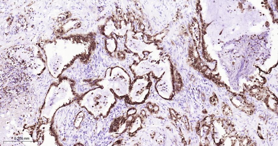 S100钙结合蛋白P重组兔单抗
