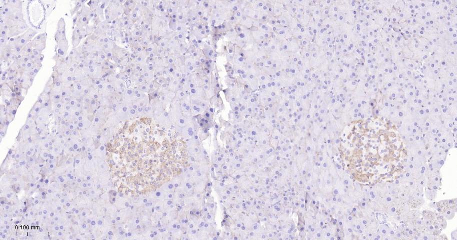 生长抑素受体2重组兔单抗