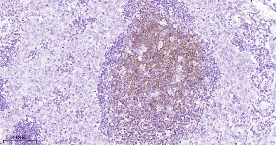 生长抑素受体2重组兔单抗