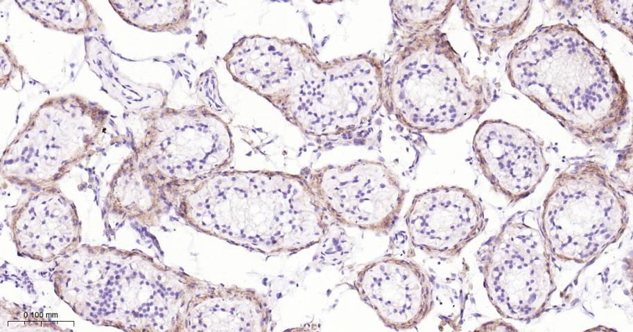蛋白聚糖Versican重组兔单抗
