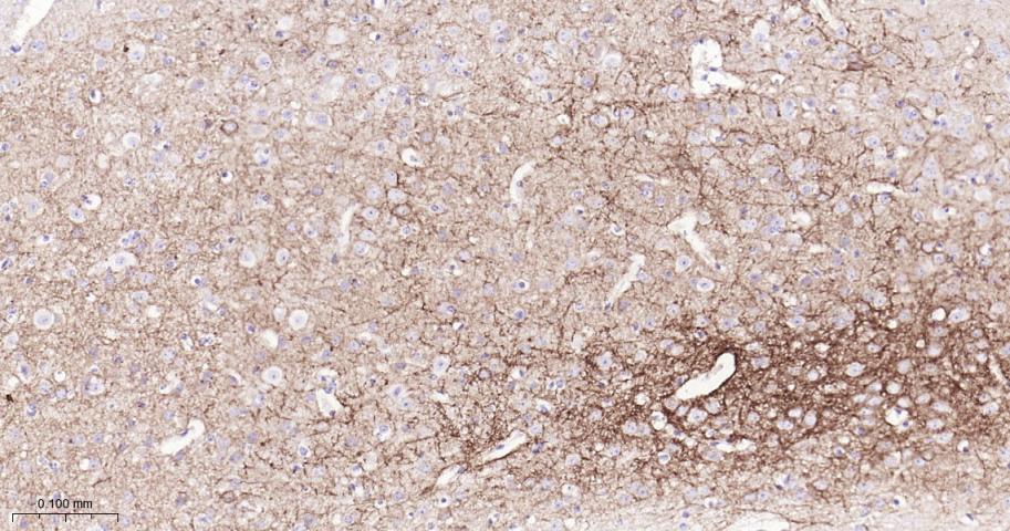 生长抑素受体2重组兔单抗