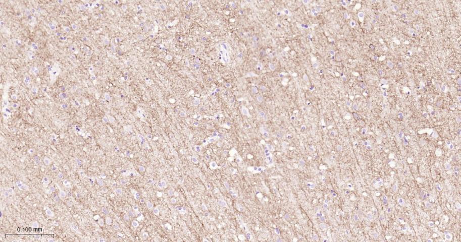 生长抑素受体2重组兔单抗