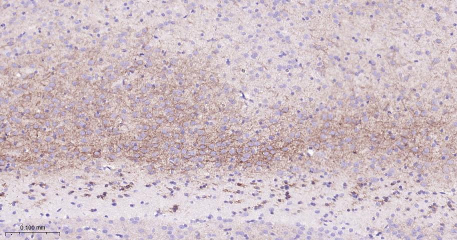 生长抑素受体2重组兔单抗