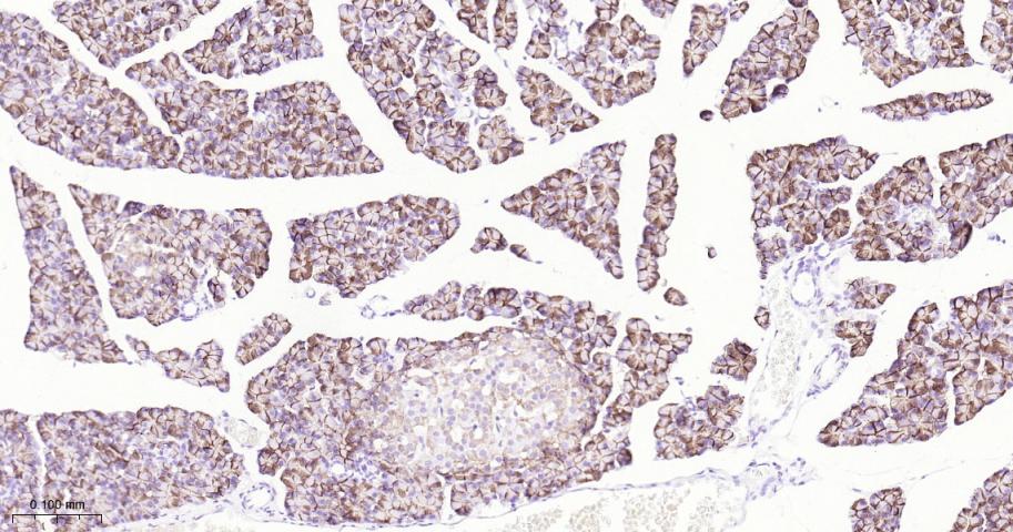 生长抑素受体2重组兔单抗