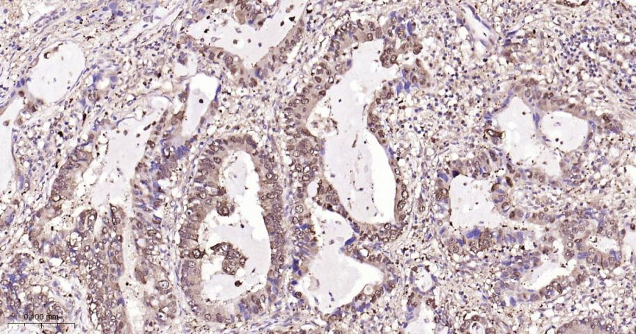 谷胱甘肽硫转移酶pi重组兔单抗
