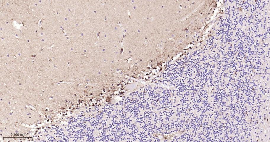 谷胱甘肽硫转移酶pi重组兔单抗
