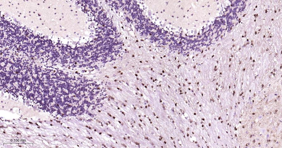谷胱甘肽硫转移酶pi重组兔单抗