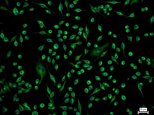 低分子量神经丝蛋白重组兔单抗-bsm-41836R