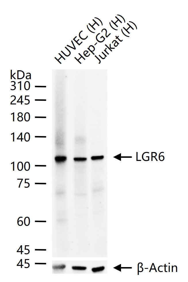 G蛋白偶联受体6重组兔单抗
