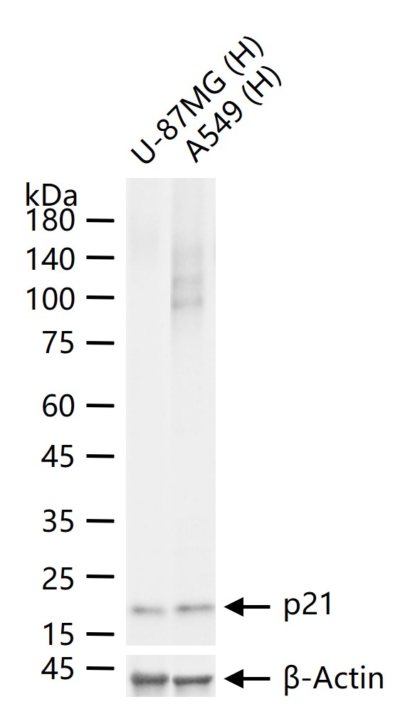 p21蛋白重组兔单抗