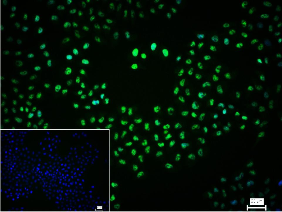 热休克因子1重组兔单抗