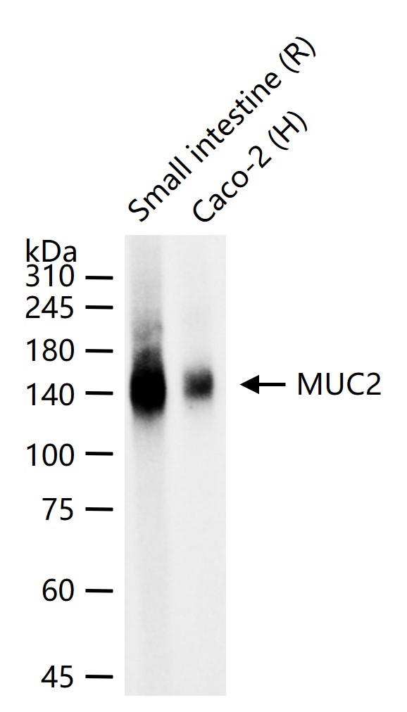 粘蛋白-2/上皮膜抗原2重组兔单抗